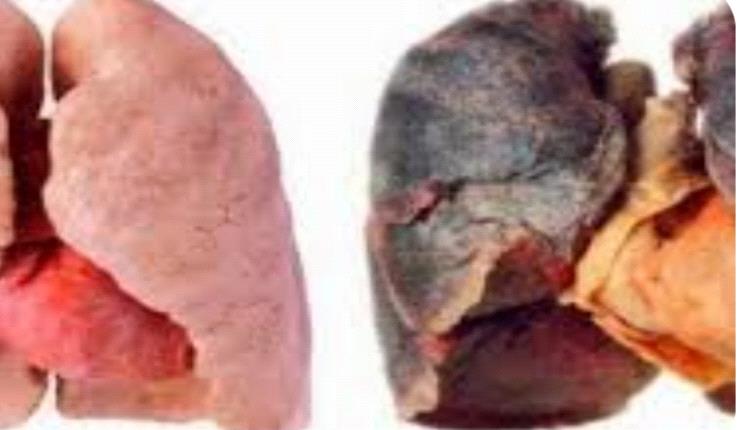 العلاقة بين التدخين السلبي وسرطان الرئة
